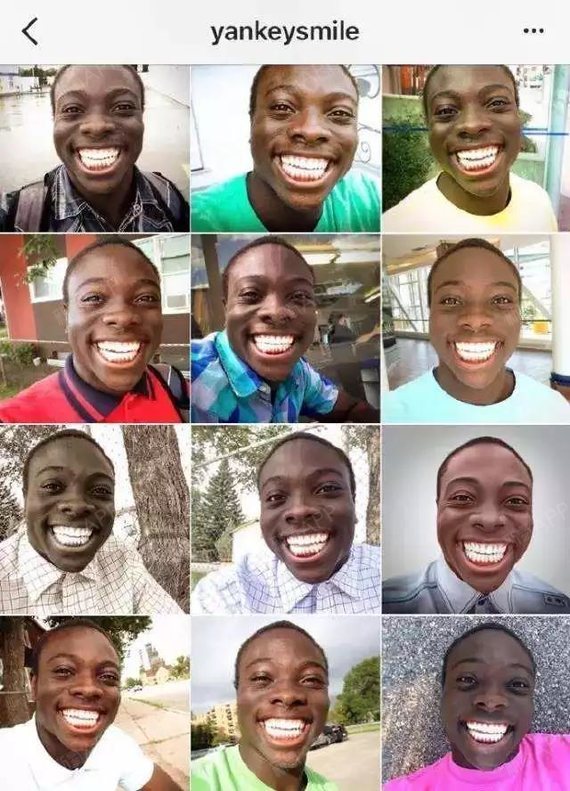 说真的,非洲人的牙白是自带技能吗?