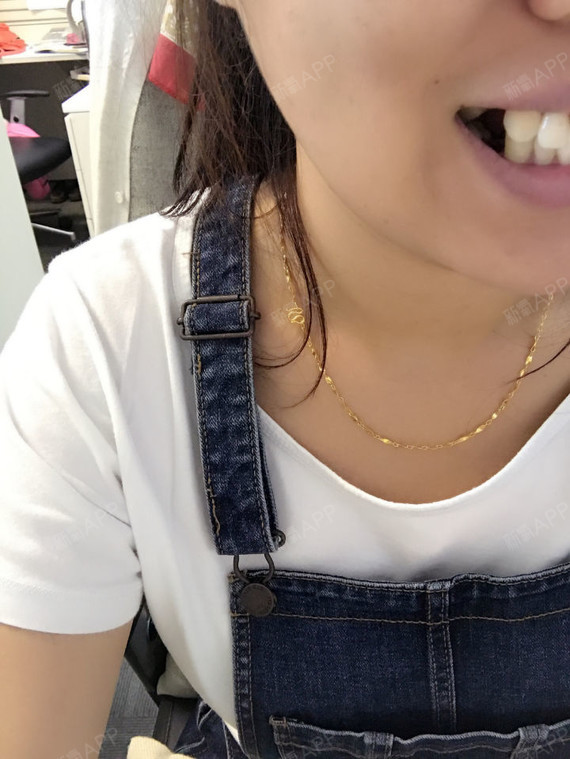 现在坐等明天去医院上牙套,明天开始我也要变成牙套妹了!