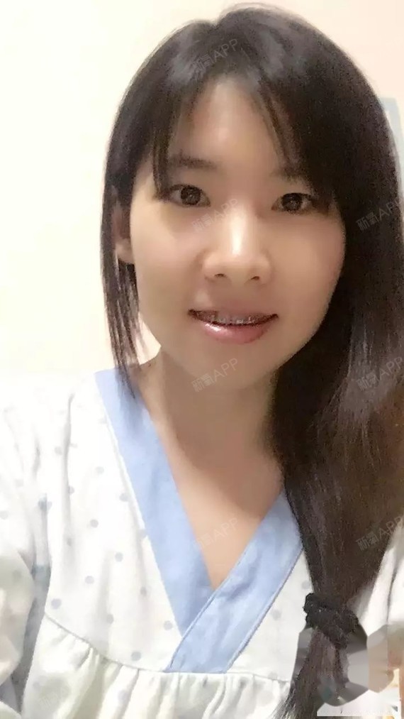 太阳穴又有凹陷了,嘴唇一圈还有点麻木,笑起来有一点小瘪嘴