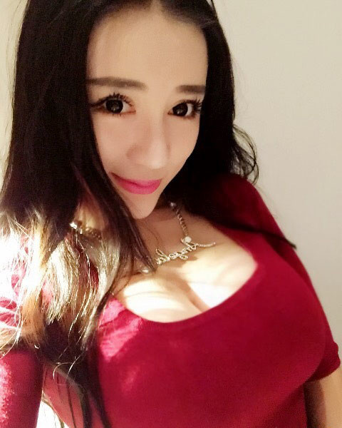 假体隆胸240效果图,400cc假体效果图 假体隆胸怎么样_恢复过程_效果如何_氧气10k5s整形10.