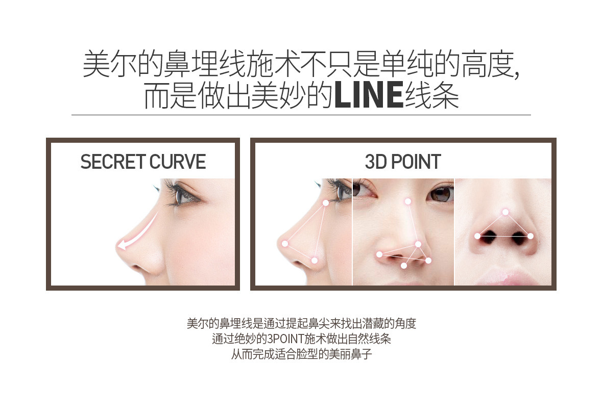 埋线隆鼻第0天