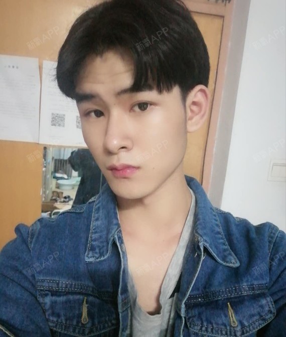 男生整形怎么了?我就做了双眼皮