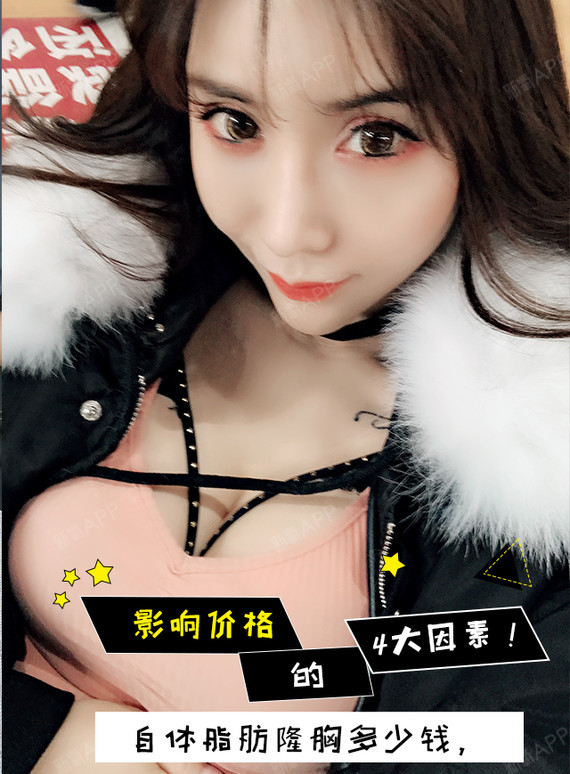 自体脂肪隆胸多少钱,影响价格的4大因素!