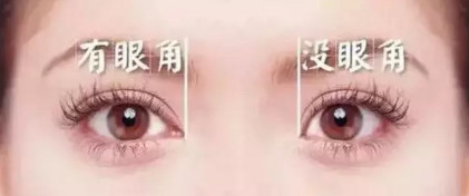 做完双眼皮手术,眼睛真的会变大吗?