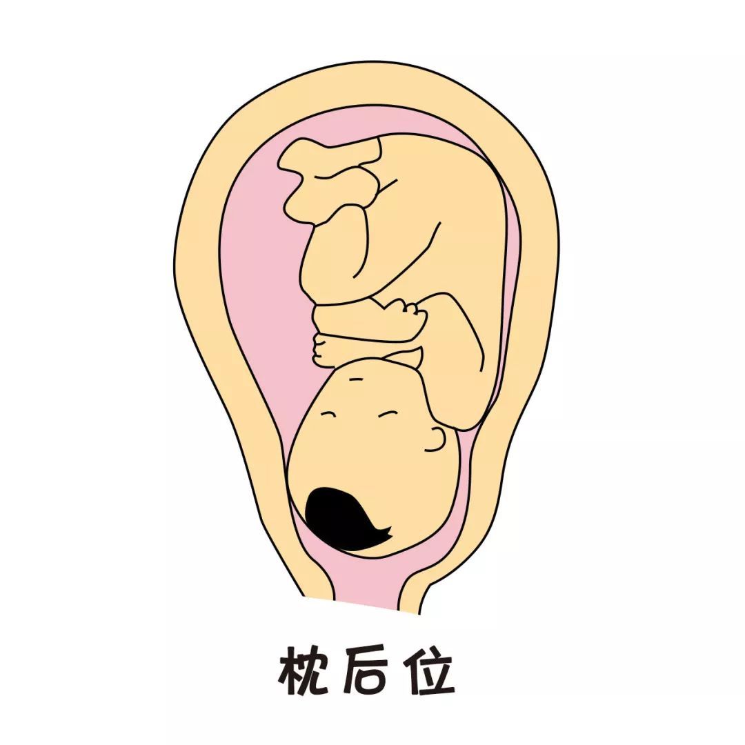 明明白白做超声(十三)：胎方位的超声检查 - 知乎
