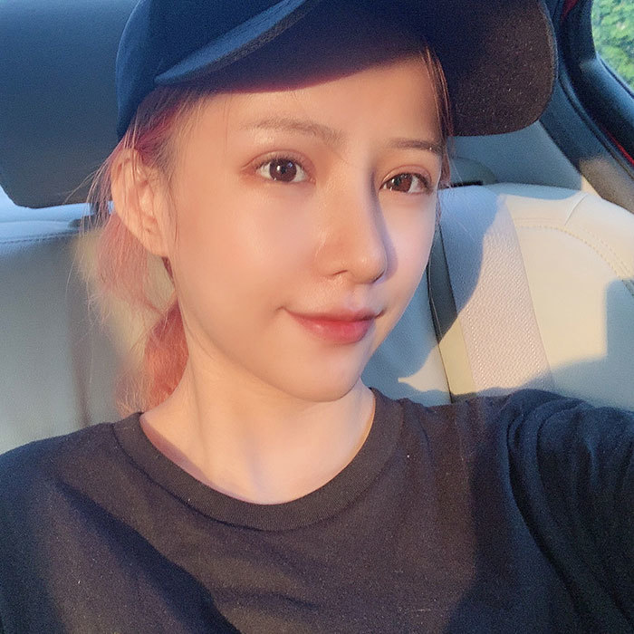 做全切双眼皮要多长时间恢复自然?