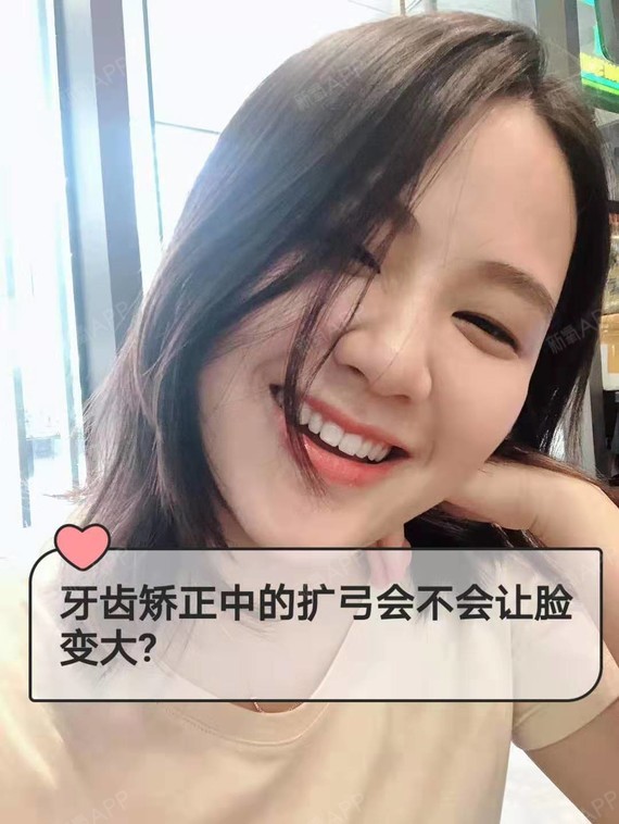 牙齿矫正中的扩弓会不会让脸变大?