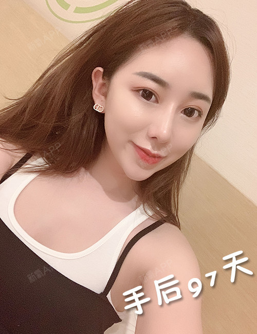 办法鼻也想有高视频鼻梁高的人没鼻梁理解我们盖伊驼峰图片