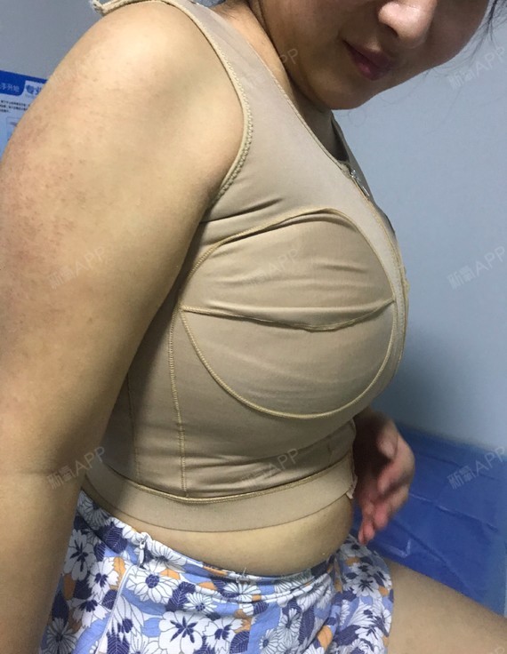 我不露脸,大家可以看到我嘴上的笑容是真实的,因为现在的胸是真的好看