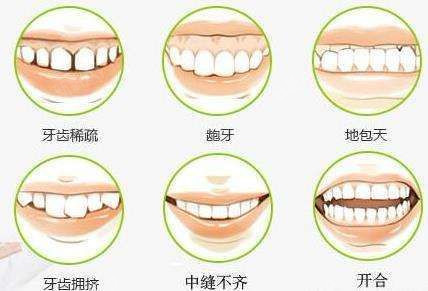 一般来说,成年人会比小孩矫正价格要高,因为成年人牙齿状况已经成型