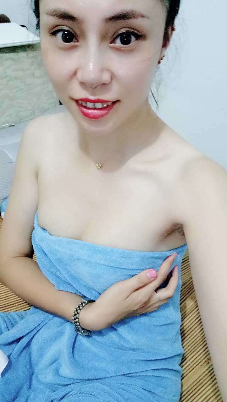 自体脂肪隆胸第10天