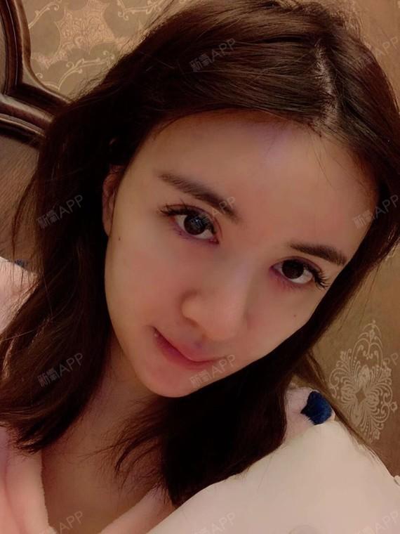 那些在怡脂做过面部填充的人现在怎么样了▲女生男相