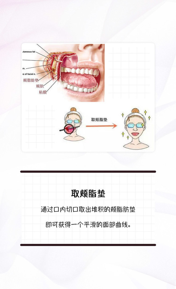 颊脂垫就是我_圈子-新氧美容整形