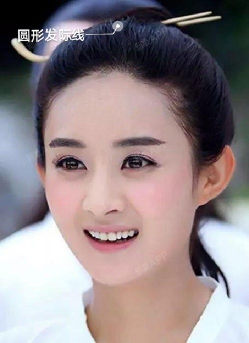 发际线形状该如何选择?