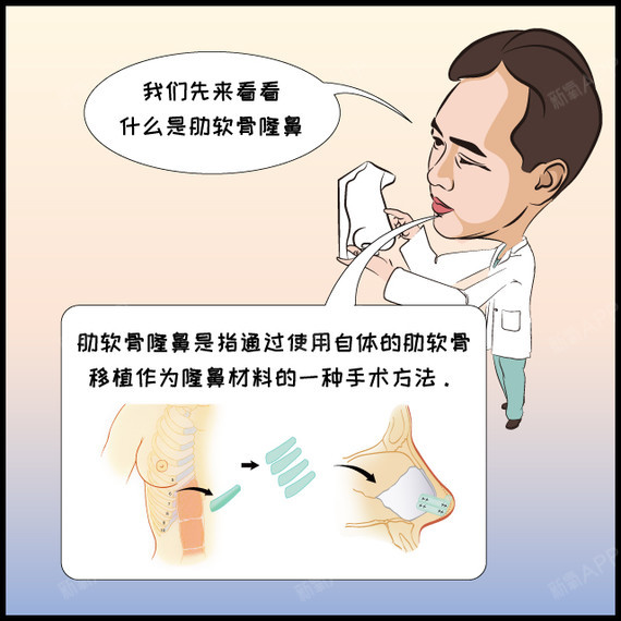 直白漫画告诉你,半肋和全肋隆鼻如何选