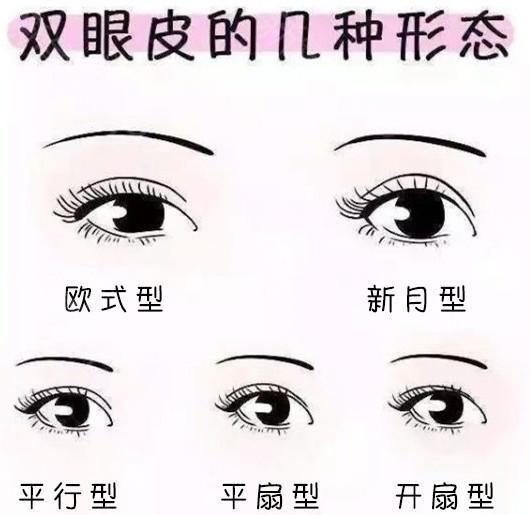 双眼皮一般分为5个类型:平扇型双眼皮,开扇型双眼皮,平行型双眼皮