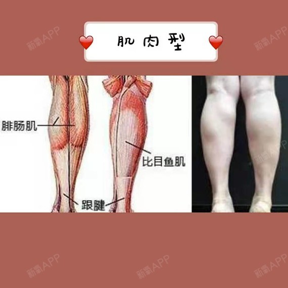 肌肉型小腿是指小腿肌肉较为发达的一种小腿类型