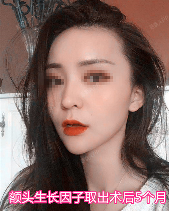 注射生长因子组织疯长,有特效药吗?能不能抽出来?
