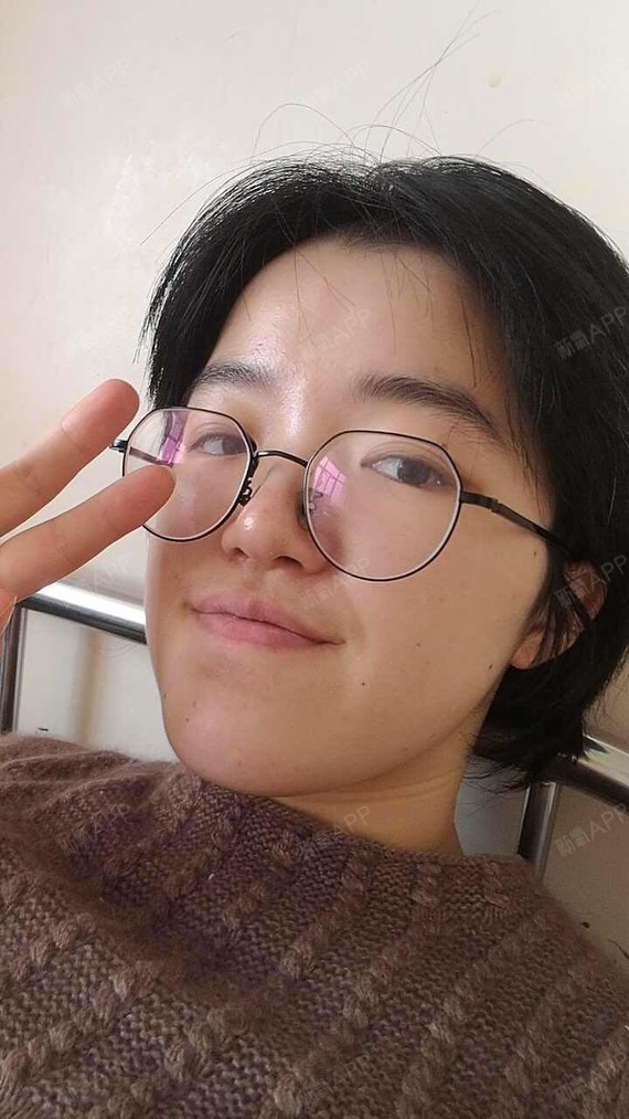 地包天,咬合不好影响身体,九院正畸 蔡鸣正颌,一切都会好的