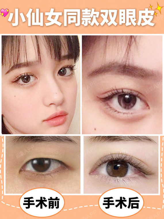 好喜欢我的桃花眼,真是越看越爱 #双眼皮# #天津_圈子