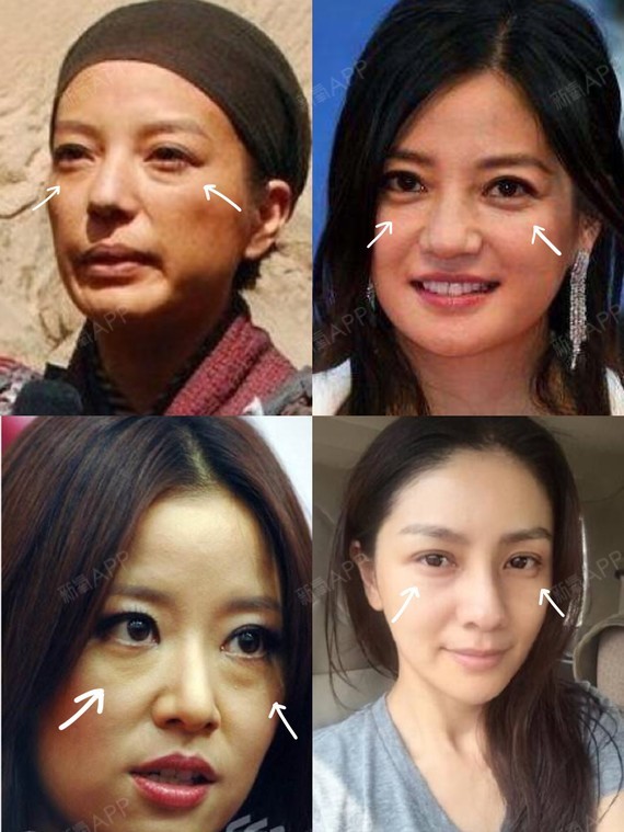 赵薇高圆圆的颜值亮点,让她们老的更快?近日黄晓明在
