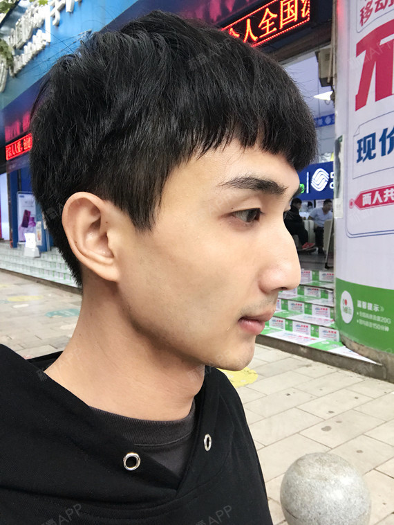 为什么男生切下颌角通常都比女生少