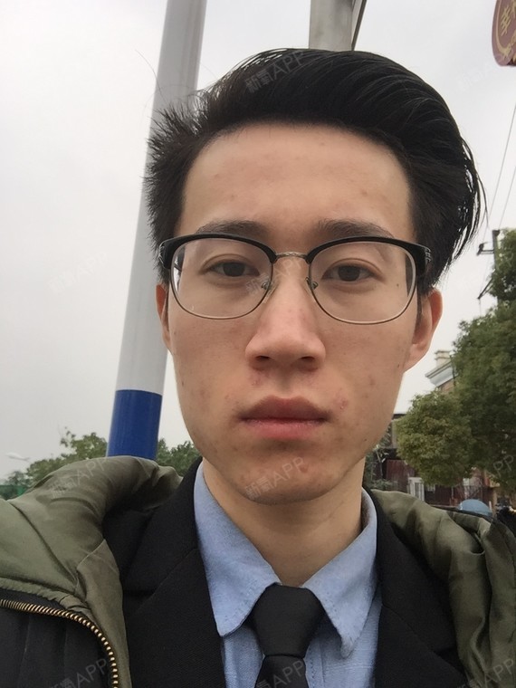 变成了现在的歪下巴歪脸,真的很苦恼,怕死了别人给我拍照.