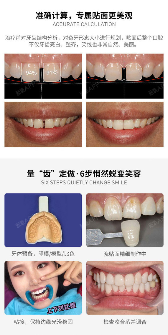 【全瓷牙】①解决黄牙,牙齿不齐,牙齿缝隙②不伤牙,色泽稳定