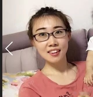 牙齿矫正