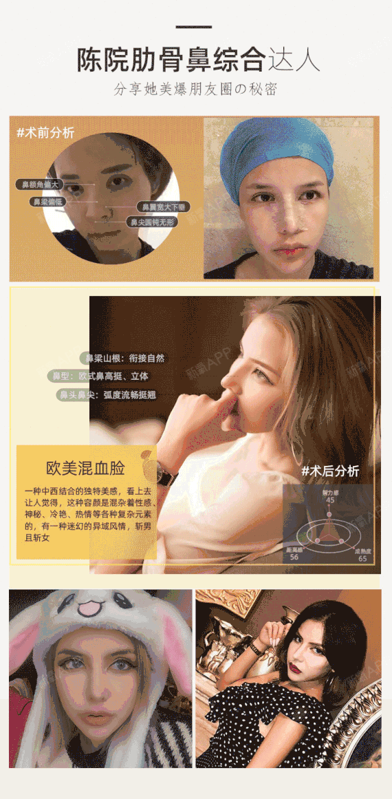 【肋软骨隆鼻】【全肋鼻部多项】【混血芭比软糖鼻】【神秘名医大咖亲