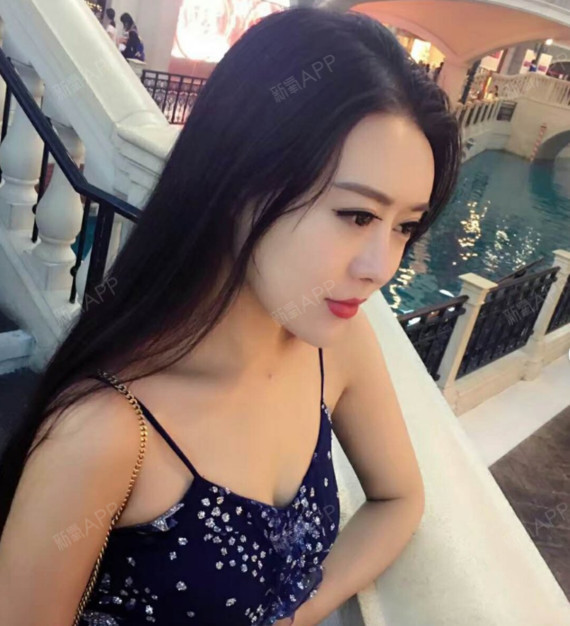 自体脂肪填充胸部案例分享