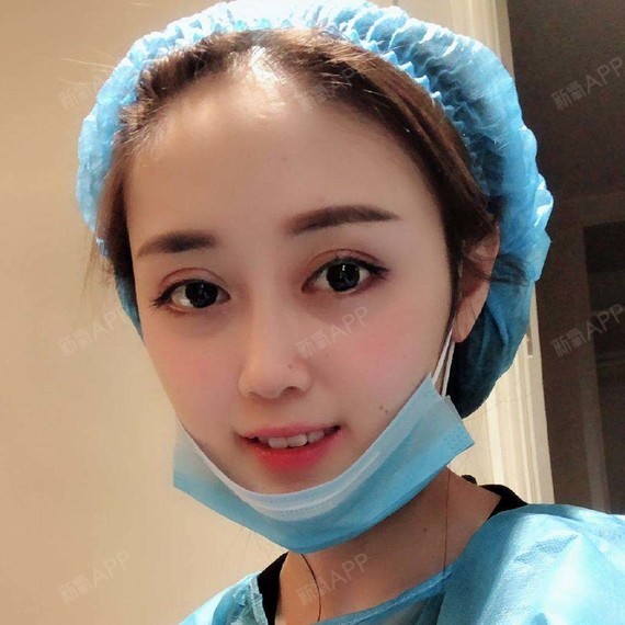 96很多有"金鱼眼"同款眼_圈子-新氧美容整形