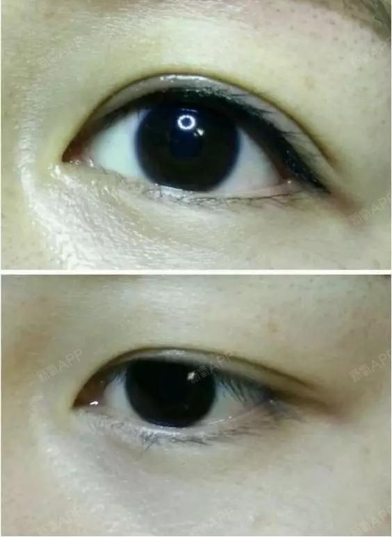 美瞳线是纹在睫毛根部的一条线,既填补了睫毛之间的空隙,在视觉效果