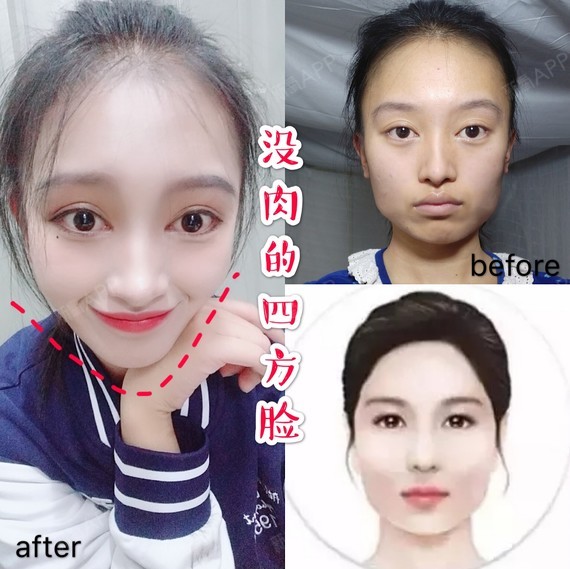 999999小v脸大行其道,让国字脸,四方脸女性心碎不已_圈子-新氧