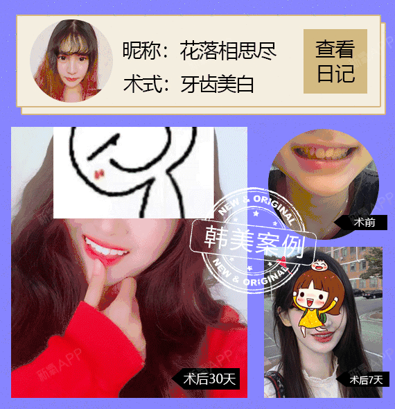 【冷光美白】【韩美周年庆典】微微一笑很倾城,让笑容