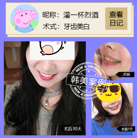 【冷光美白】【韩美周年庆典】微微一笑很倾城,让笑容