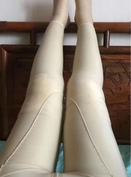 吸脂瘦大腿第56天