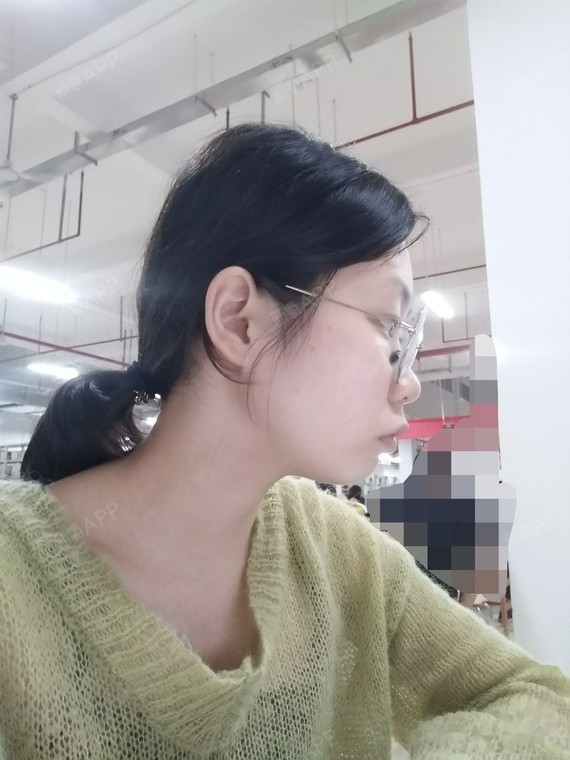 牙齿矫正
