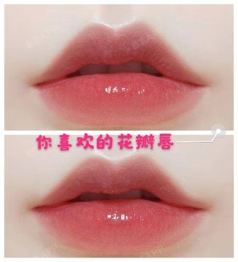 花瓣唇