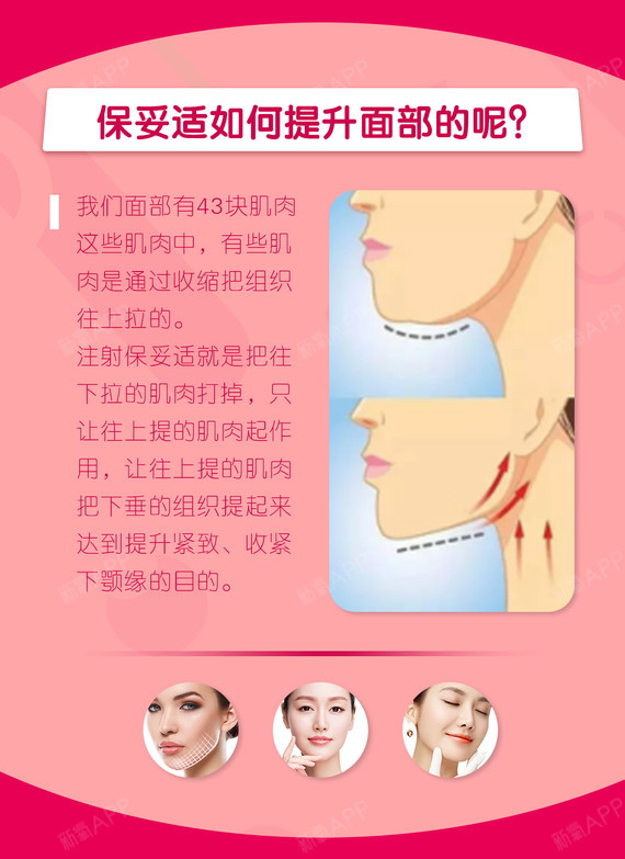 【除皱瘦脸】保妥适 除皱瘦脸 50单位 ,【下颌缘提升】多层次面部注射