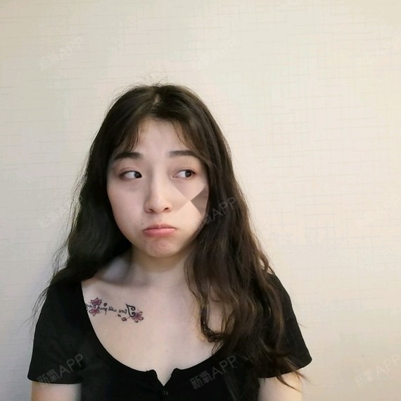 眼睛700度的瞎子视力竟然恢复到1.