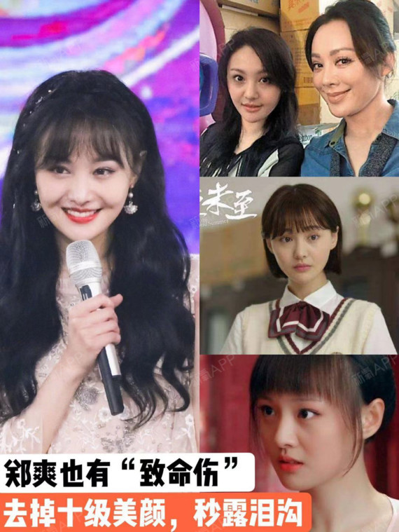 爽妹子关掉美颜滤镜,比黑眼圈更可怕的是泪沟!