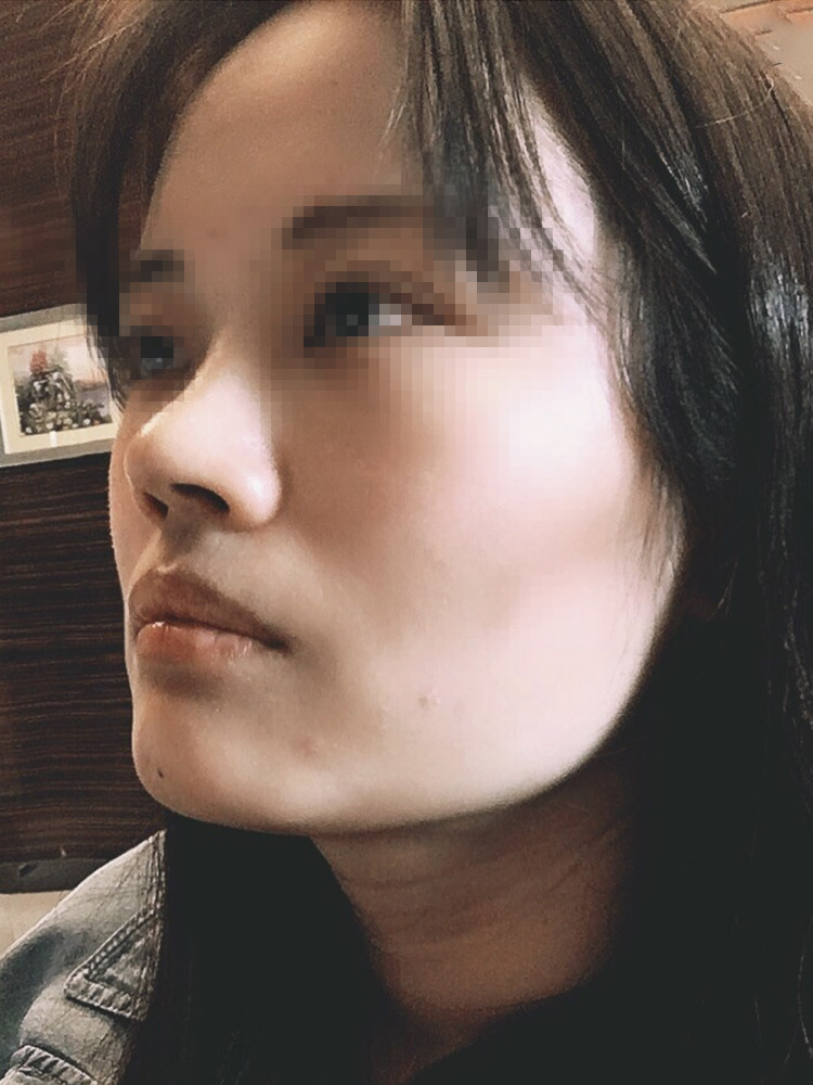 如何拯救大脸扁平脸颧骨高脸型