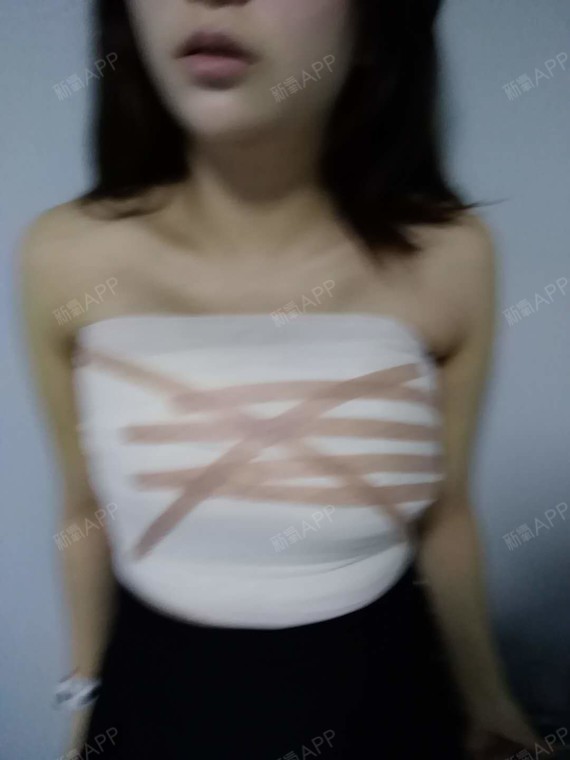 深圳乳房下垂矫正好不好_效果图_我最可爱啊乳房下垂5