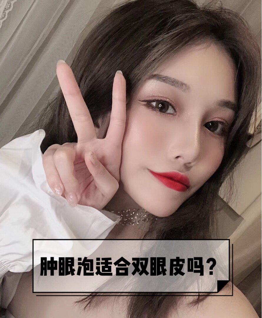 肿眼泡适合做双眼皮吗?