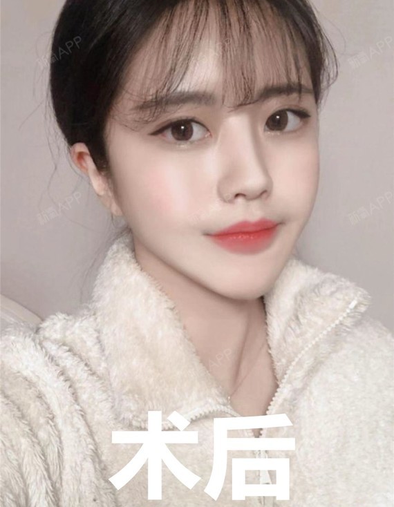 暴瘦的10斤,脸还是那么大?