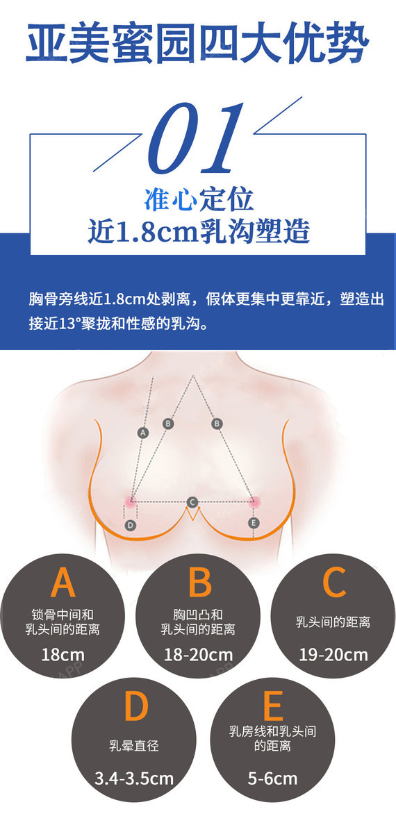 【假体隆胸】【蓓拉假体 】源自韩国{不满意终身免费置换假体} 小底盘