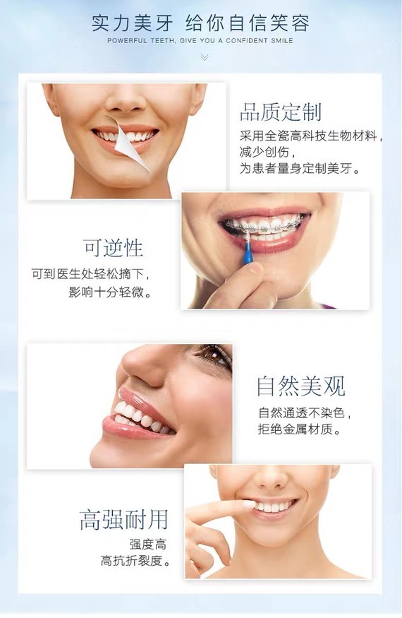 【瓷贴面】【emax超薄瓷贴面】【全口16颗打包不含其它任何费用】