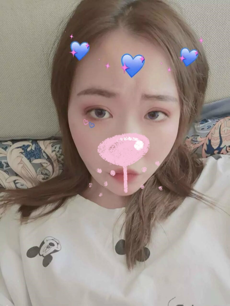 比基尼线脱毛第8天