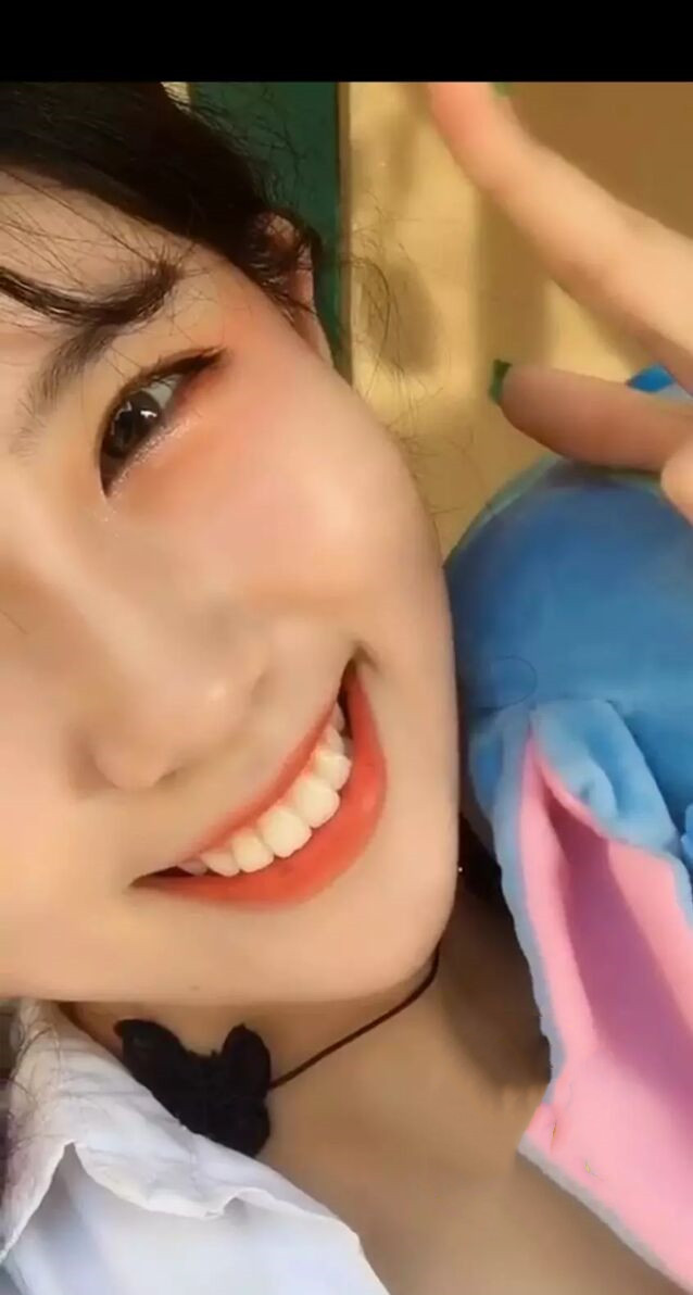 比基尼线脱毛第30天